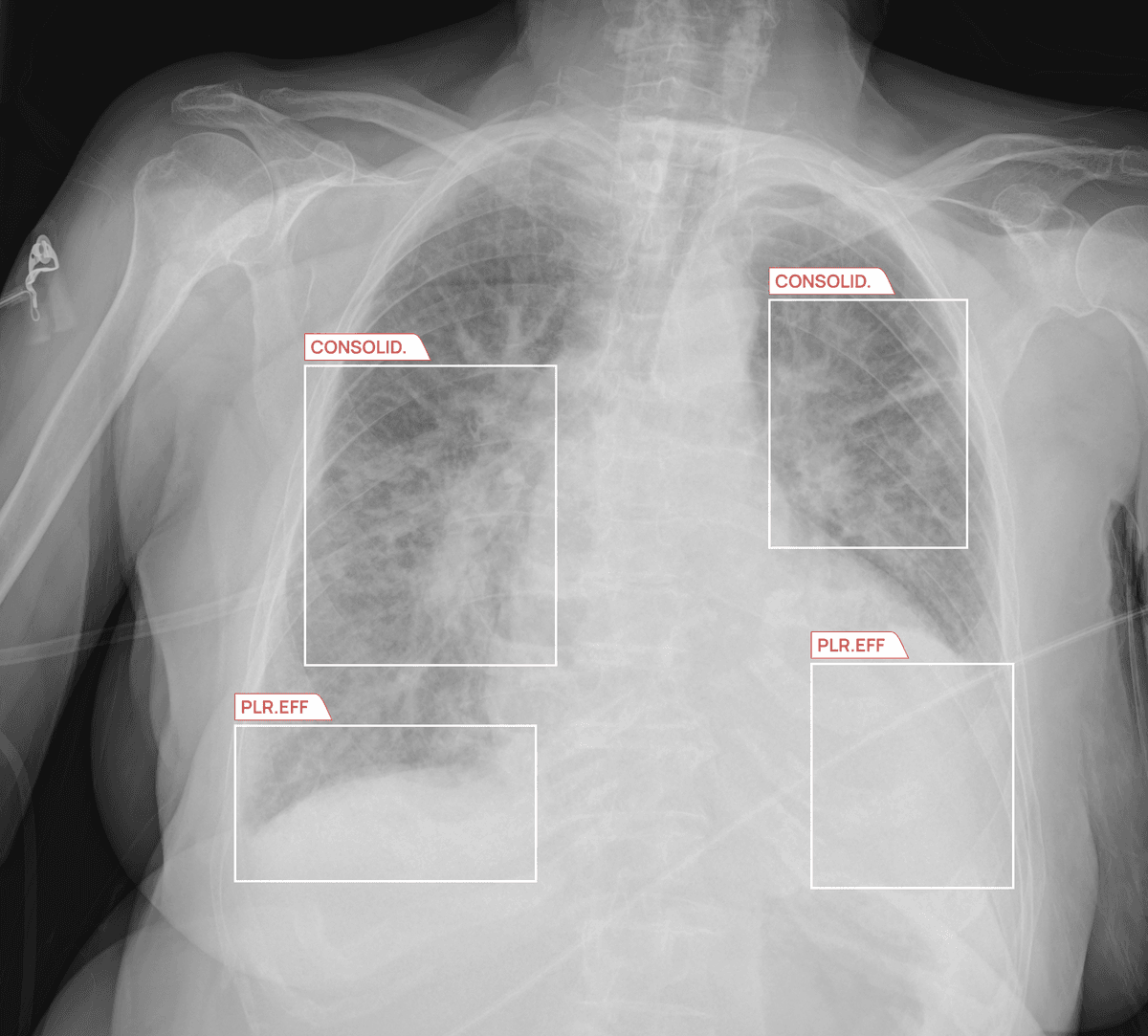Sample AZchest output