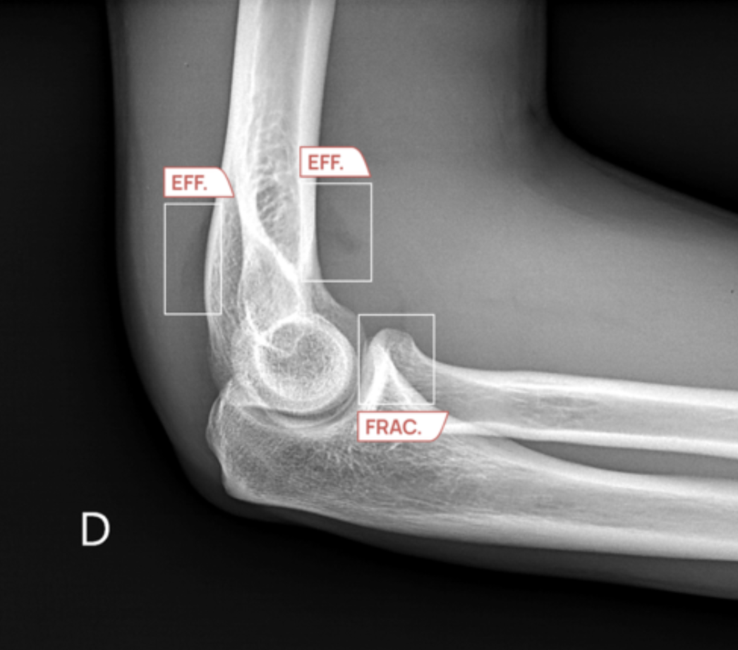Sample AZtrauma output