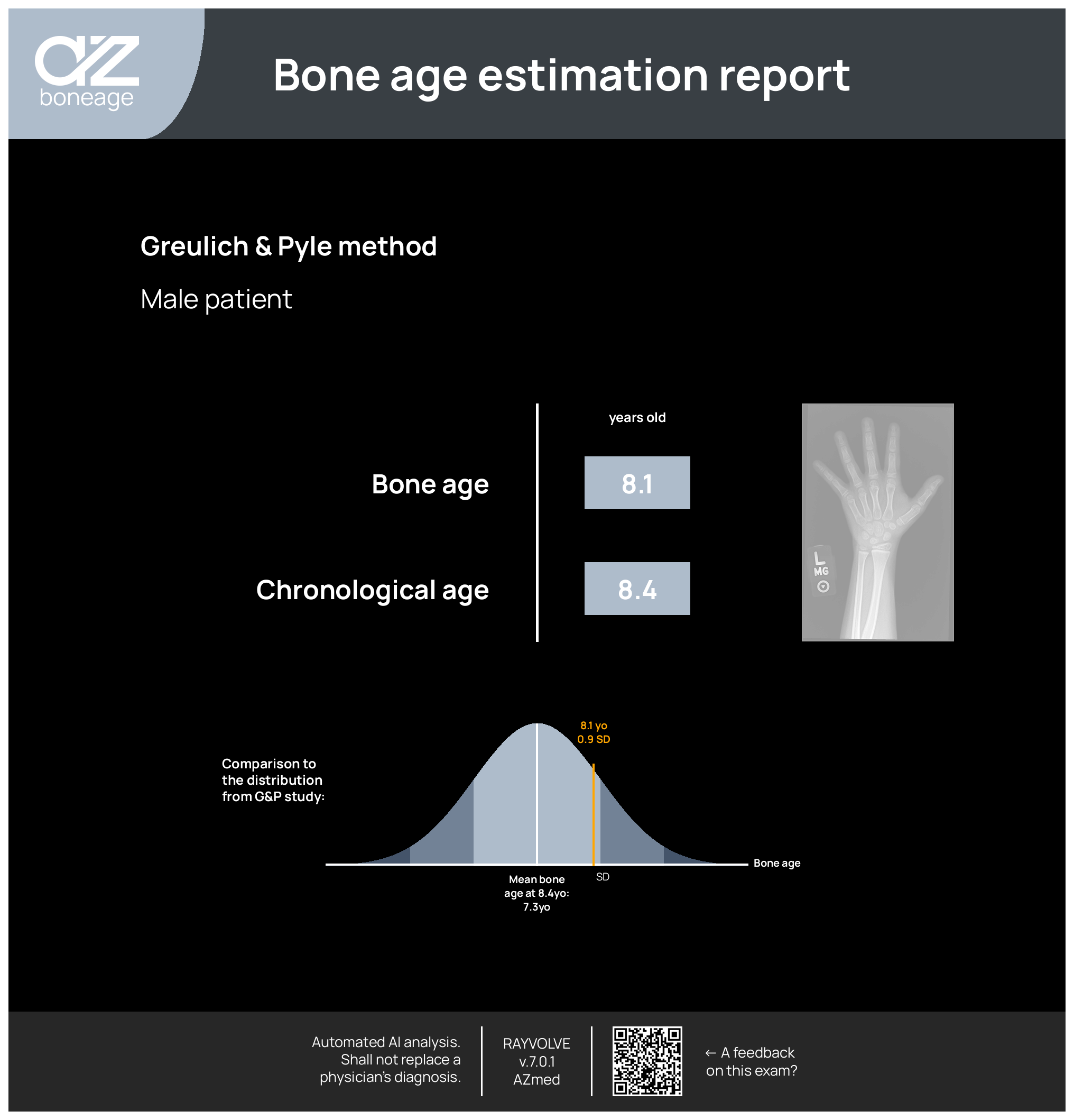 Sample AZboneage output